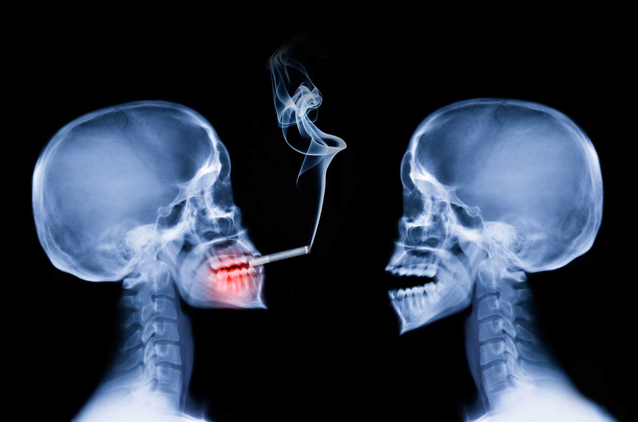 Advertencia sobre el alcohol: ¿podrán las etiquetas cambiar nuestros hábitos? 1 Advertencia sobre el alcohol ¿podran las etiquetas cambiar nuestros habitos